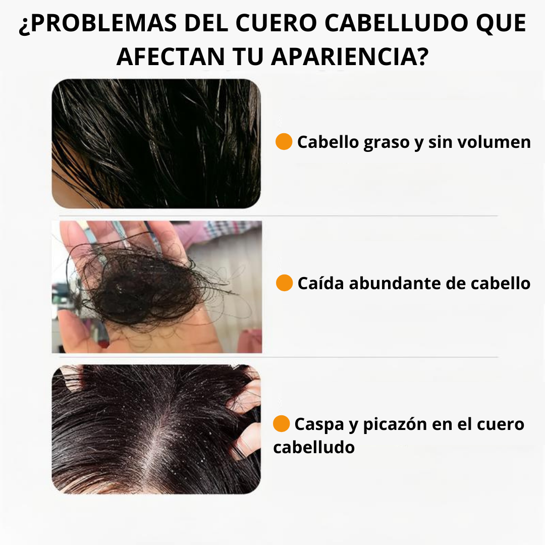 Shampoo Anti-Caída Remimpi - Con un 30% de descuento
