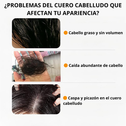 Shampoo Anti-Caída Remimpi - Con un 30% de descuento